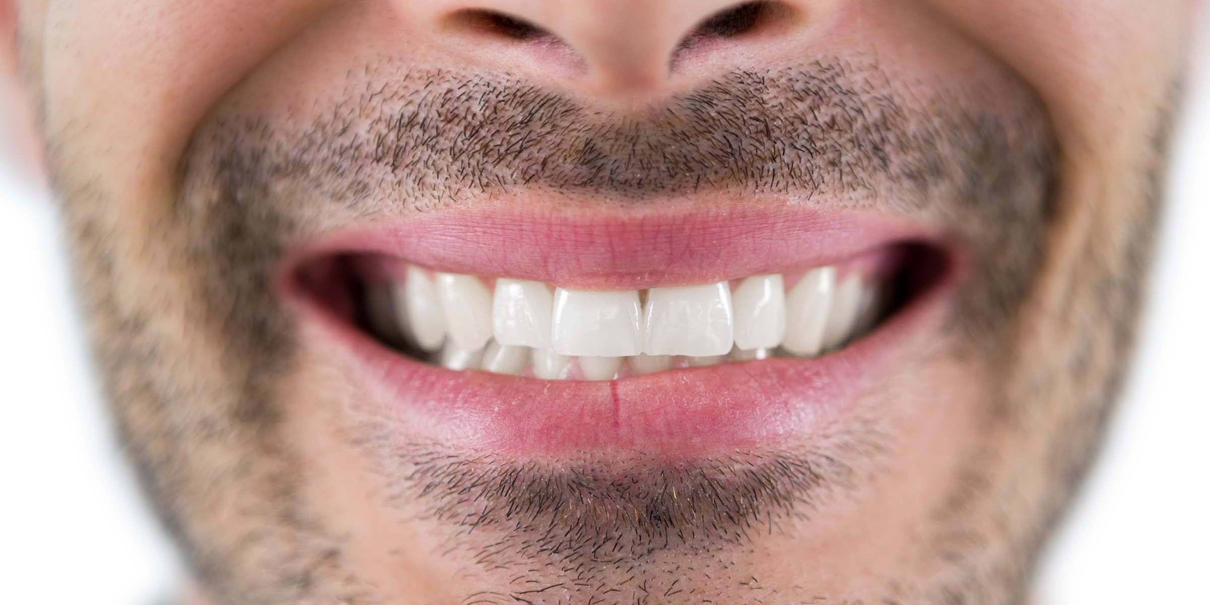After Teeth Whitening